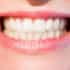 Is it Safe to Get Dental Implants in Costa Rica
